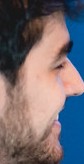 Face of Zantins