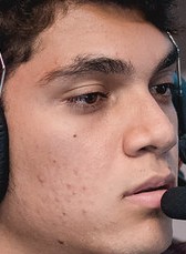 Face of Zirigui