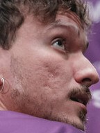 Face of micaO