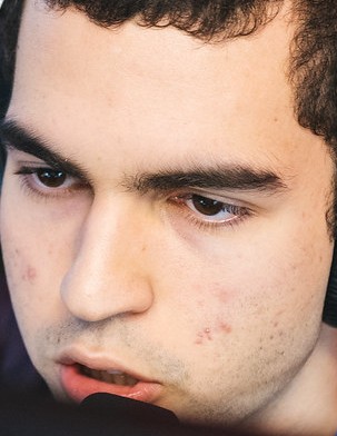 Face of SkyBart
