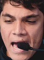 Face of Zirigui