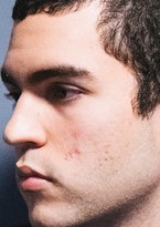 Face of SkyBart