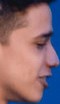 Face of 4LaN
