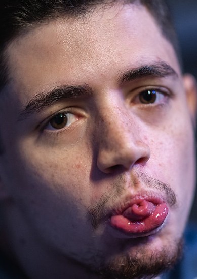 Face of Wos