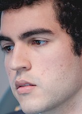 Face of SkyBart