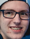 Face of Yampi