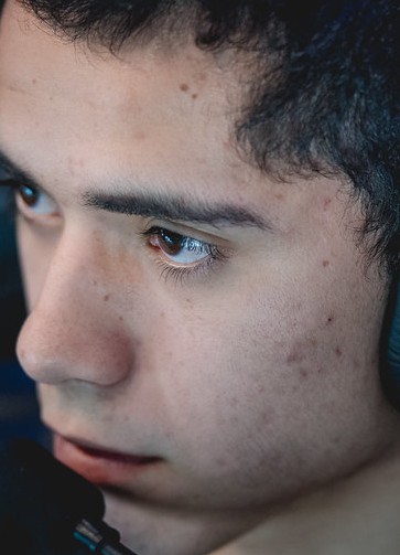 Face of Ceos