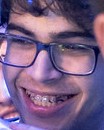 Face of Fitz