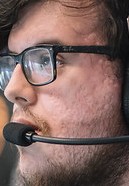 Face of Jockster