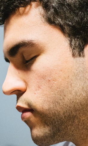 Face of SkyBart