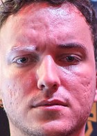Face of micaO