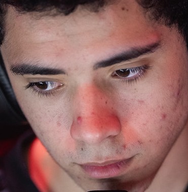 Face of Ceos