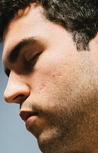 Face of SkyBart