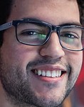 Face of SkyBart