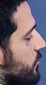 Face of brTT