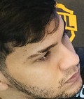 Face of DudsTheBoy