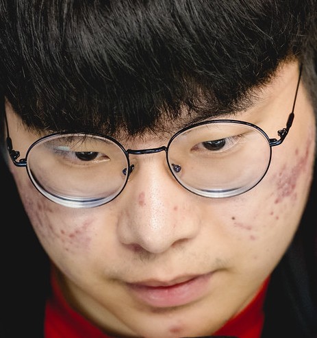 Face of WooFe