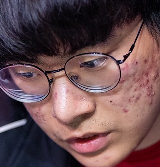 Face of WooFe