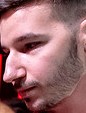 Face of Sting
