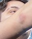 Face 4