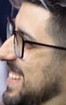 Face of Hypno
