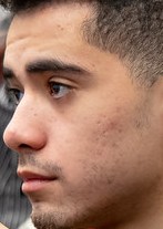 Face of Ceos