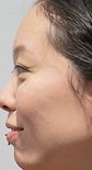 Face 3