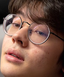 Face of Boal