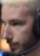 Face of Sting
