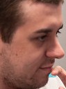 Face of Accez