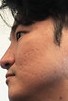 Face 1