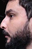 Face of Nappon