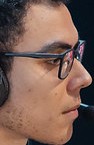 Face of Damage
