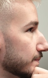 Face of Sting