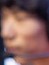 Face of ADD