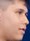 Face of Brance