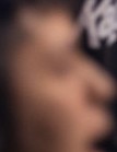 Face 5