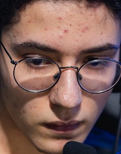 Face of uZent