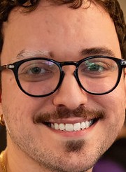 Face of micaO