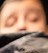 Face 1