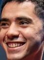 Face of Ceos