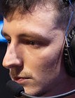 Face of Yupps