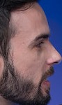 Face 1