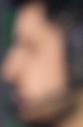 Face 1