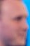 Face 1