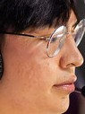 Face of Ganks