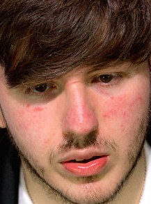 Face of Snaker