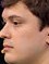 Face of Dionrray