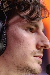 Face of Yupps